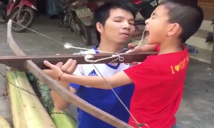Clip: Ông bố dùng nỏ nhổ răng cho con trai