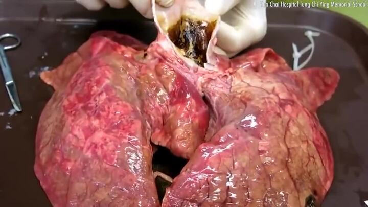 Một giờ hít khói thuốc lá độc hại bằng hút 10 điếu