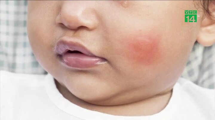 Con trai 4 tuổi bị bố 'cắn yêu' đến chết