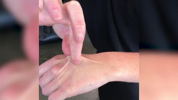 Nắng nóng, chuyên gia chỉ cách kiểm tra cơ thể đủ nước trong nháy mắt