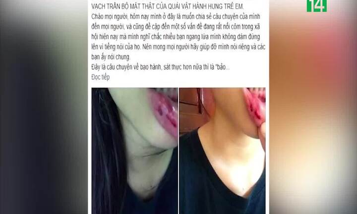 BTV Minh Tiệp bị tố bạo hành: Nữ sinh và gia đình lên tiếng