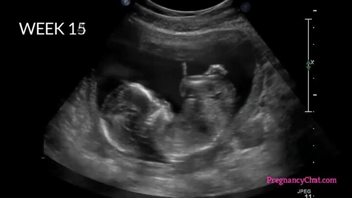 Tiến trình thai nhi lớn lên từ khi trứng gặp tinh trùng