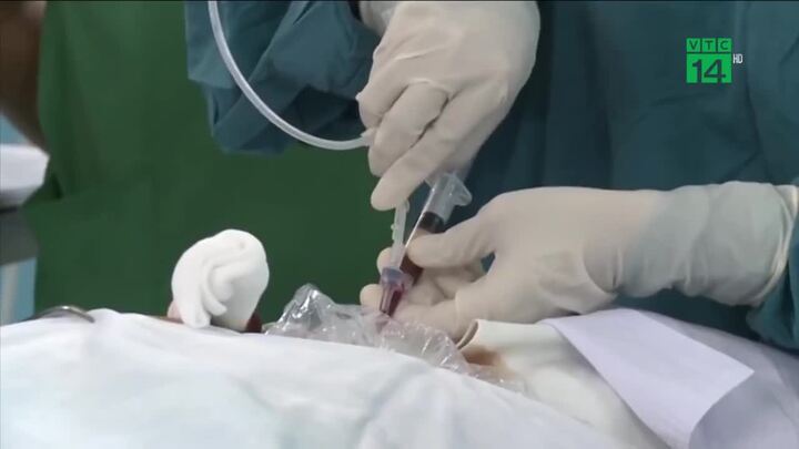 Cắt bỏ thành công khối bướu dạ dày nặng 4kg