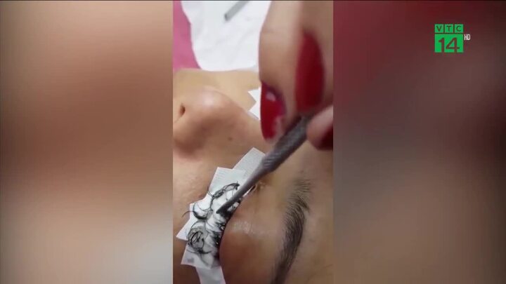 Nối mi bằng keo dán sắt, cô gái rụng sạch lông mi