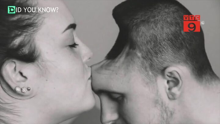 Lạm dụng nước tăng lực, người đàn ông mất nửa bộ não