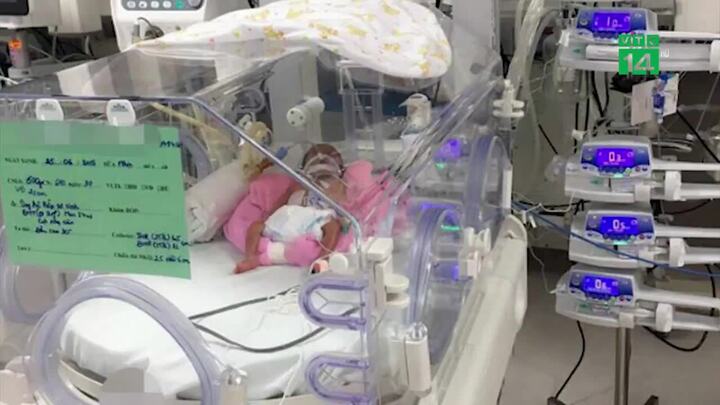 Clip: Nuôi dưỡng thành công bé sinh non nặng 600 gr