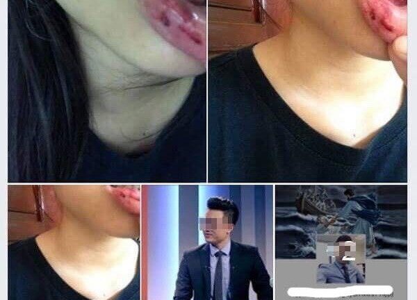 MC Minh Tiệp bị tố đánh em vợ: Thông tin chính thức