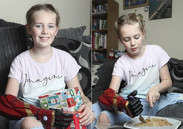 Cô bé không tay bẩm sinh được lắp tay giả điều khiển bằng điện tử