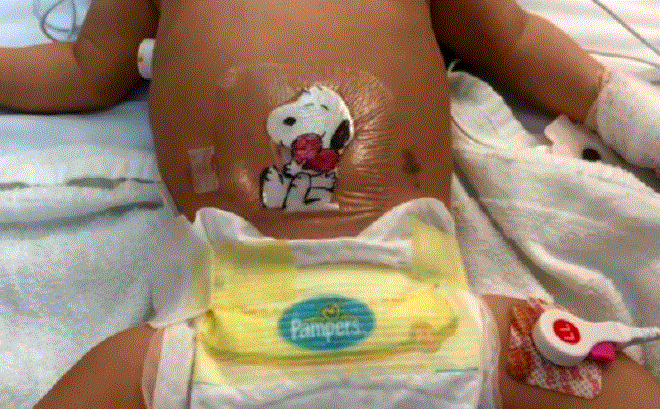 Bác sĩ vẽ nhân vật ngộ nghĩnh che vết mổ cho bệnh nhi