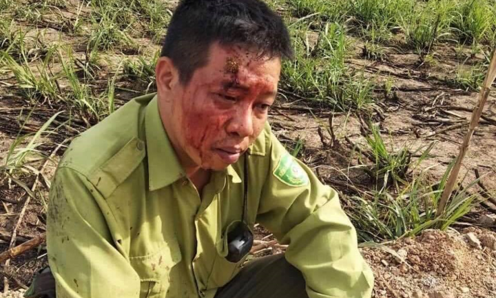 Bị phát hiện chuyển gỗ lậu, lâm tặc đánh kiểm lâm toác đầu