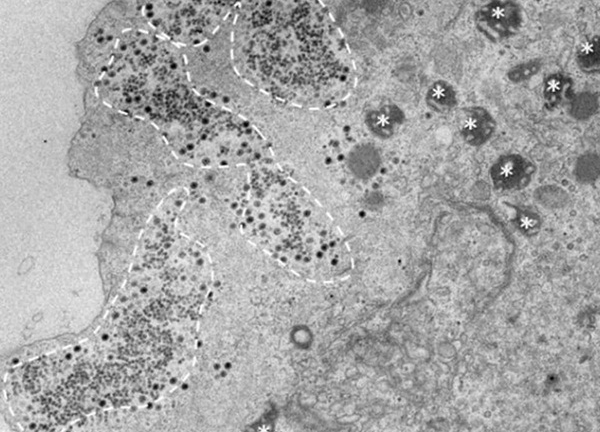 Phát hiện virus bí ẩn, không thể xác định gen ở Brazil