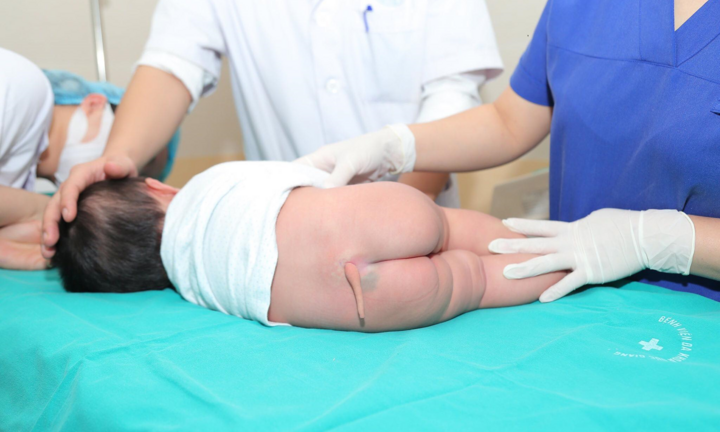 Cắt đuôi dài gần 10cm cho bệnh nhi 5 tháng tuổi