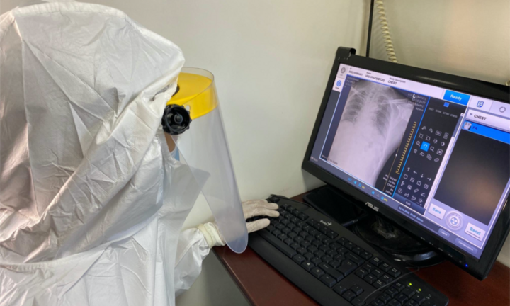 Sức khỏe 3 bệnh nhân nhiễm virus corona ở TP.HCM giờ ra sao?