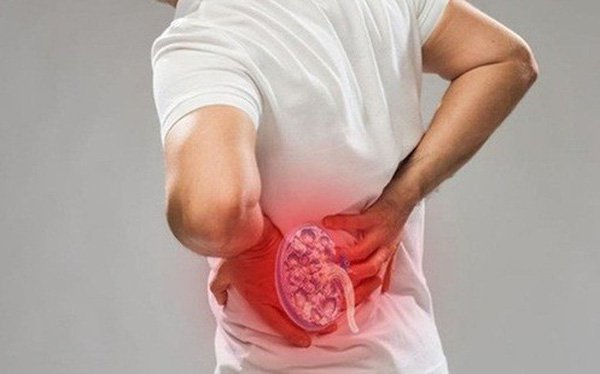 10 thực phẩm gây sỏi thận cần tránh ăn nhiều