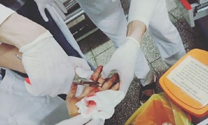 Thiếu tá công an bị con nghiện chém đứt gân tay