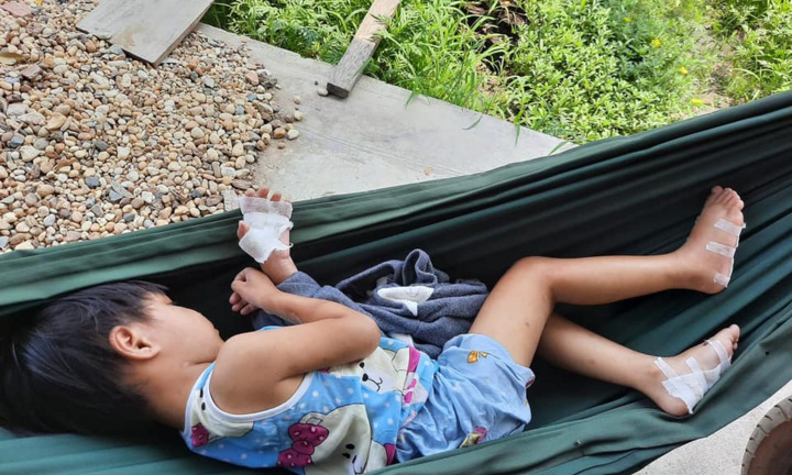 Cha dượng bạo hành dã man bé gái 4 tuổi: Tỉnh Tây Ninh chỉ đạo xử nghiêm