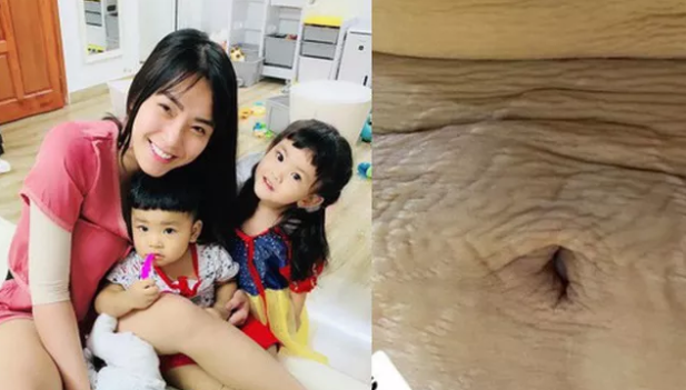 Hải Băng chia sẻ hình ảnh vòng 2 đầy vết rạn da chằng chịt, nhiều bà mẹ đồng cảm