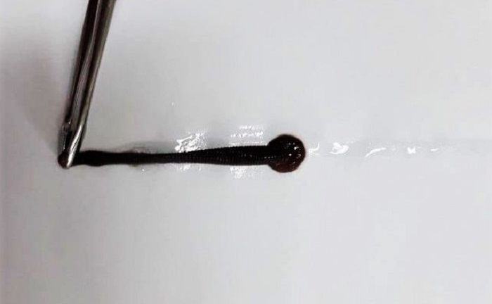 Con đỉa ký sinh 10 ngày trong mũi người phụ nữ ở Quảng Nam