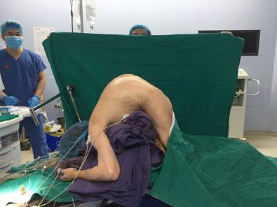 Nắn chỉnh biến dạng cột sống cho người đàn ông gù 10 năm không thể nằm ngửa