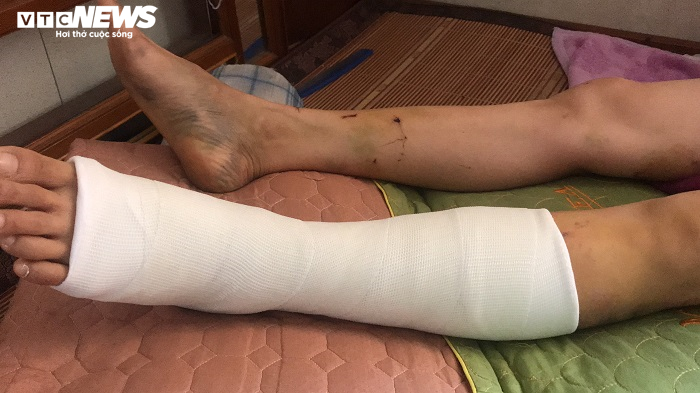 Trưởng Ban Nội chính Thái Bình gây tai nạn rồi bỏ trốn: Lời kể người thoát chết 