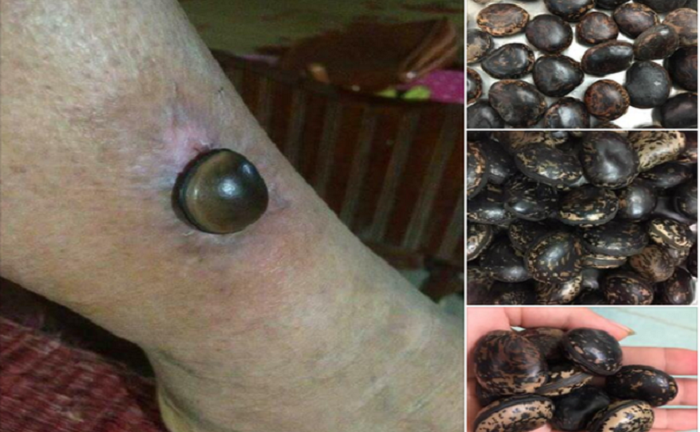 Sự thật về 'thần dược' hạt đậu Lào giá 'cắt cổ' 6 triệu đồng/kg