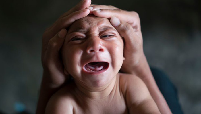 Virus Zika xuất hiện ở Đà Nẵng: Những biến chứng nguy hiểm