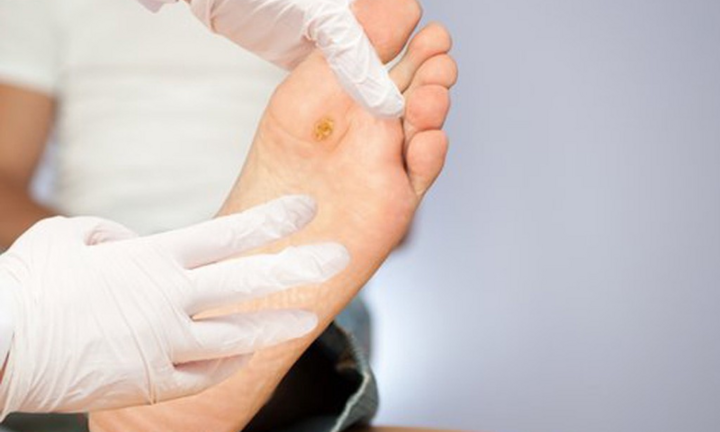 30 giây có thể mất 1 chân: Bạn cần nhớ điều này khi bị tiểu đường