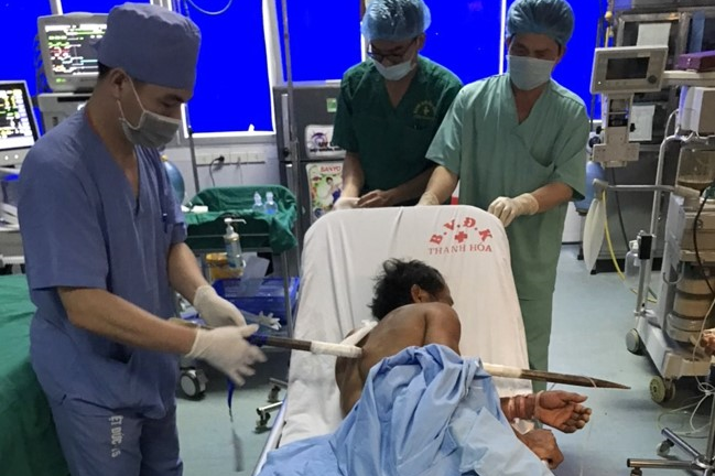 Cứu sống bệnh nhân bị xà beng đâm xuyên ngực 