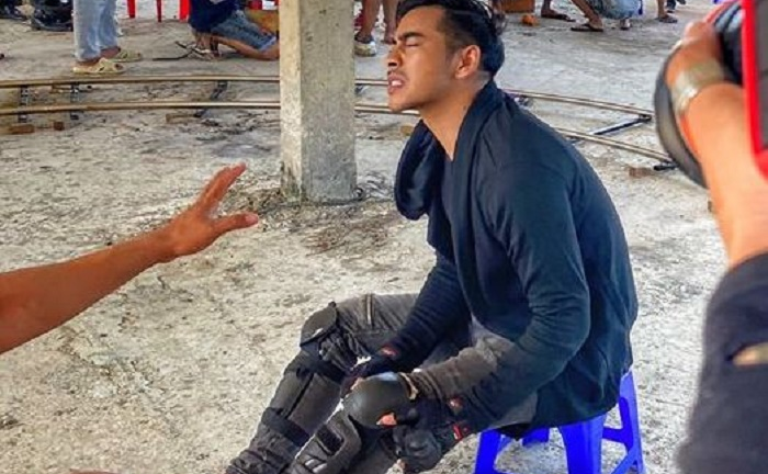 Diễn viên Thanh Bình bị vỡ sụn gối, chảy máu mắt trên phim trường