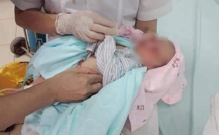 Bé trai sơ sinh sống sót thần kỳ sau 3 ngày bị bỏ rơi dưới nắng nóng 40 độ C