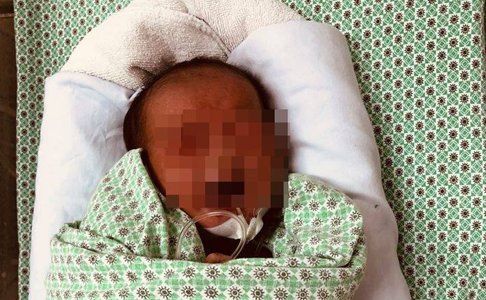 Sức khỏe bé sơ sinh bị bỏ rơi dưới nắng nóng 40 độ C hiện ra sao?