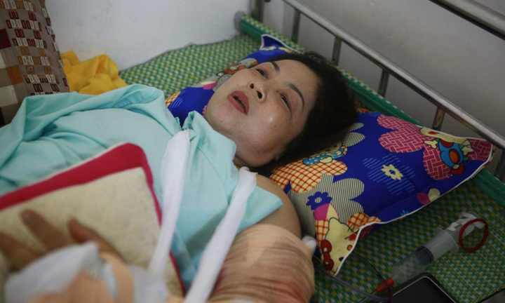 Lốc xoáy cuốn bay xưởng gỗ ở Vĩnh Phúc: Sức khỏe các nạn nhân giờ ra sao?