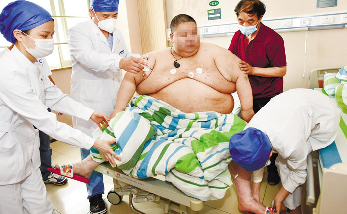 Sau thời gian cách ly vì dịch, nam thanh niên tăng thêm hơn 100kg