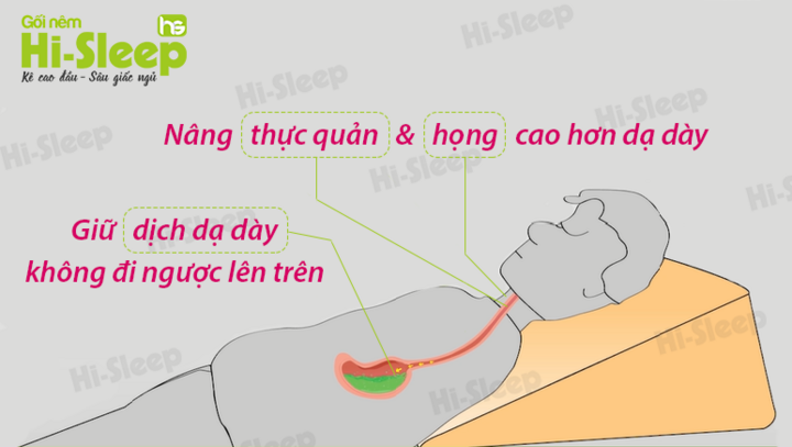 Ứng dụng C.A.M giảm viêm họng, nuốt vướng do trào ngược họng - thanh quản
