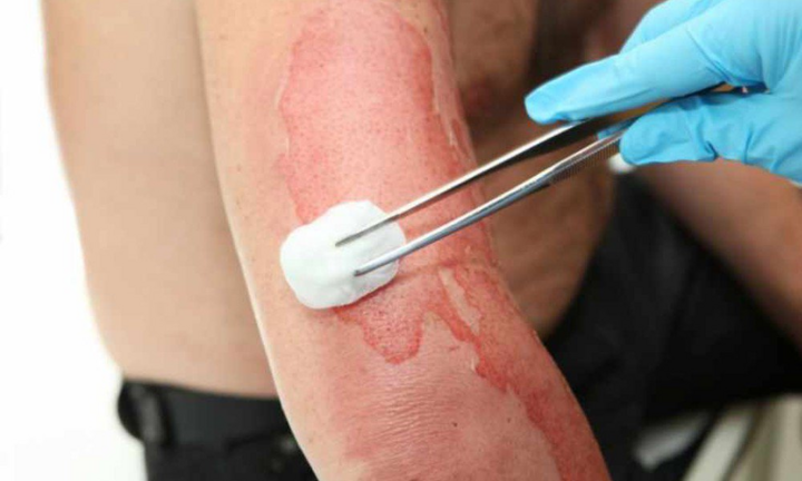 Những cách sơ cứu khi bị điện giật ai cũng phải nhớ 