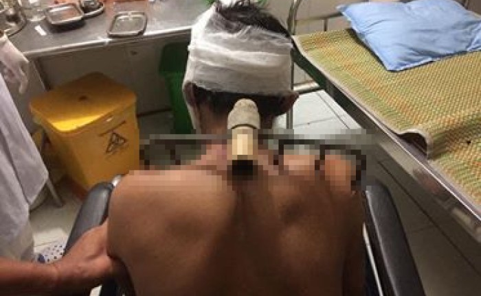 Kinh hãi con trai bổ bồ cào vào bố