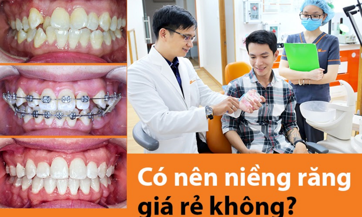 Up Dental: Niềng răng giá rẻ 1 triệu/tháng an toàn, uy tín