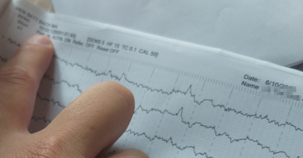 Đo điện não video 12 tiếng chỉ làm 30 phút: Bệnh viện Bạch Mai nói gì?