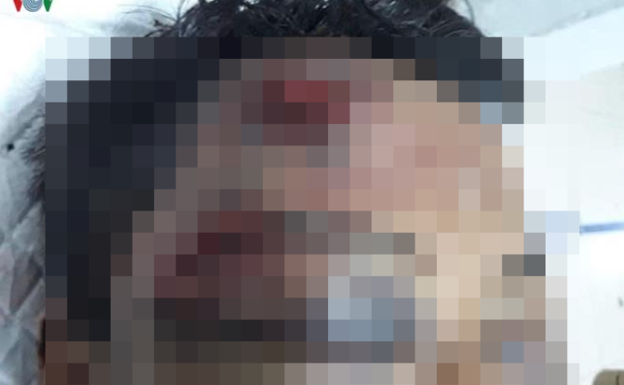 Rủ chủ nợ vào nhà uống rượu rồi trói, đánh nạn nhân nhập viện