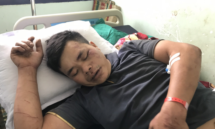 Nạn nhân vụ tai nạn ở Kon Tum: Xe chao đảo nhiều lần trước khi lao xuống vực