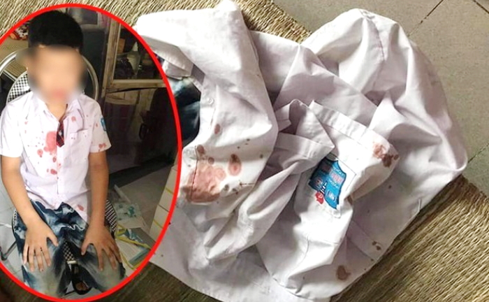 Mâu thuẫn được giải quyết nhưng bố vẫn ra tay tàn bạo với bạn học lớp 1 của con