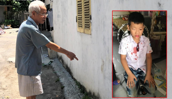 Bé lớp 1 bị bố của bạn hành hung: 'Không có người can thì hắn đánh bé đến chết'