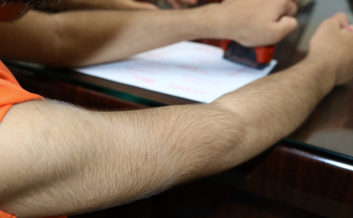 Bé gái 6 tuổi ở Vũng Tàu mắc bệnh hiếm, thế giới chỉ có 74 ca