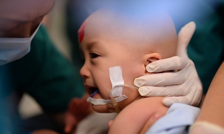 Sức khỏe cặp song sinh dính liền sau tách rời: Diệu Nhi cai máy thở, có phản xạ