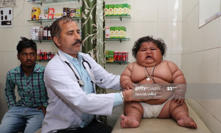 Bé gái 18 tháng tuổi nặng 17 kg, sức ăn như trẻ 10 tuổi