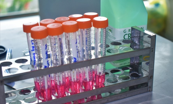 Số ca mắc COVID-19 tăng mạnh, Bộ Y tế huy động đơn vị tư nhân làm xét nghiệm