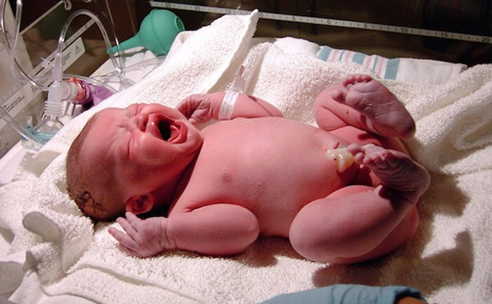 Vì sao lúc cắt dây rốn, bé khóc to còn mẹ không thấy đau?