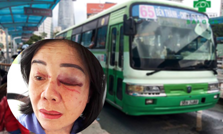 Mở nhạc to bị nhắc, gã đàn ông lao vào hành hung tím mặt nữ tiếp viên xe buýt 