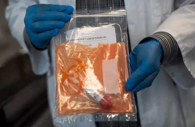 Thụy Sĩ phát hiện virus SARS-CoV-2 trong da người