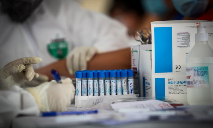 Vì sao bệnh nhân tái nhiễm SARS-CoV-2 sau nhiều tháng khỏi bệnh?